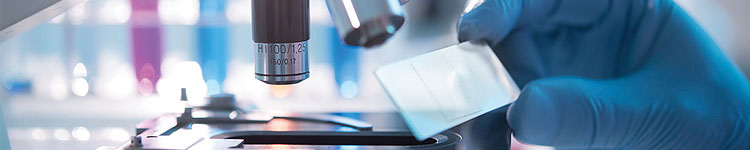 Анализы на ЗППП в Люблино