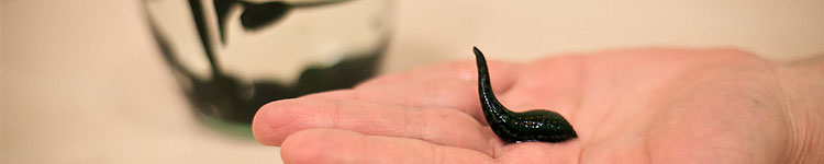 Гирудотерапия в Люблино