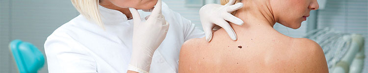 Удаление папиллом в Люблино